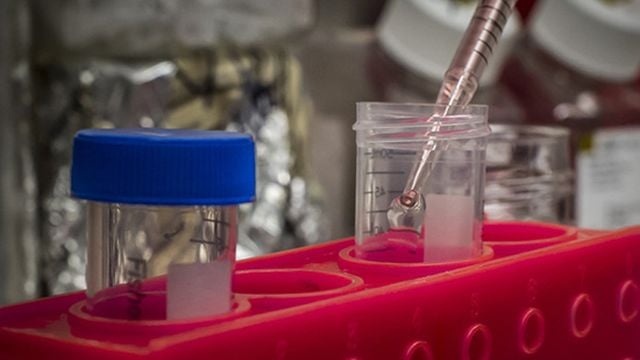 Alabama NewsCenter – New HIV mRNA vaccine study gets boost from COVID-19 messenger RNA development