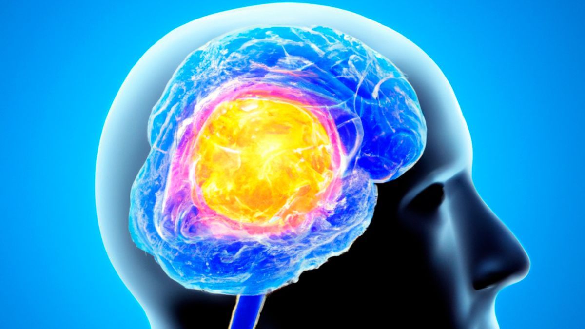 Alabama NewsCenter — UAB joins NIH study to slow bleeding in the brain